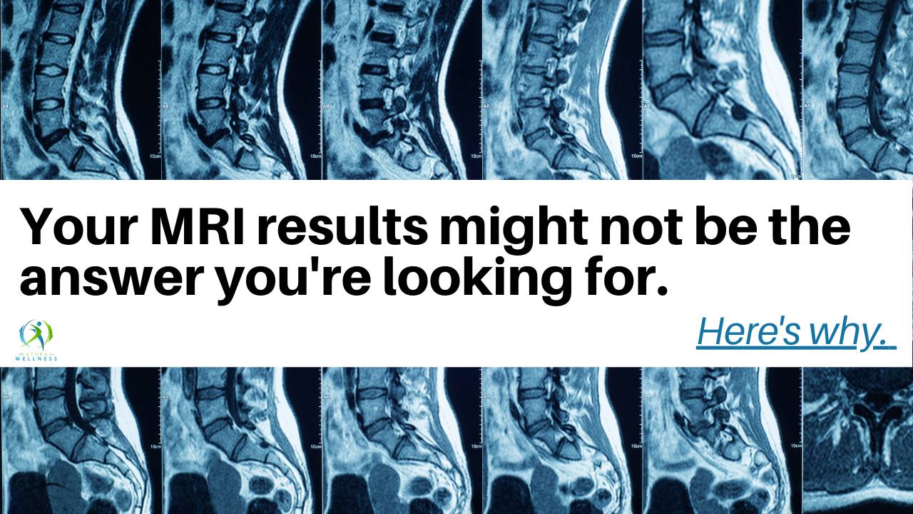 BLOG_mri