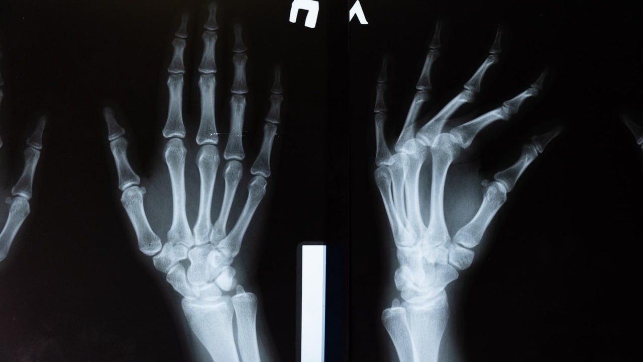 bones